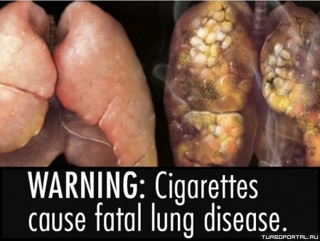Предупреждения о вреде курения на пачках сигарет в разных странах мира
